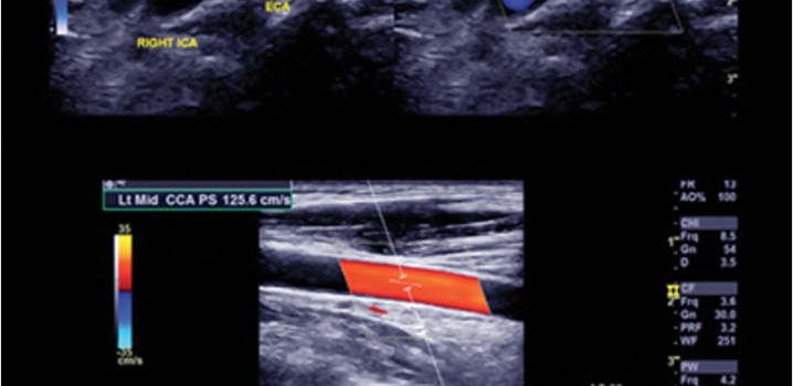 Clinical Approach to Vascular Ultrasound and RPVI Prep Course