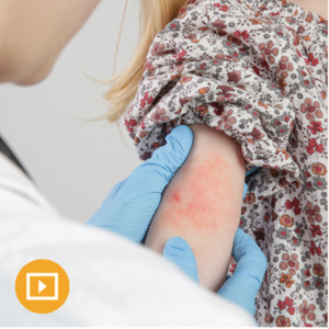 Dermatology for Primary Care