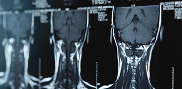Neurosurgery – A Comprehensive Review