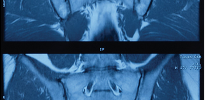UCSF Musculoskeletal Imaging