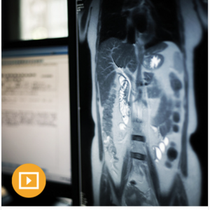 UCSF Abdominal & Pelvic Imaging