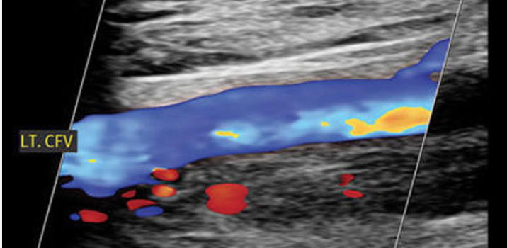 Clinical Approach to Vascular Ultrasound and RPVI Prep Course Clinical Approach to Vascular Ultrasound and RPVI Prep Course