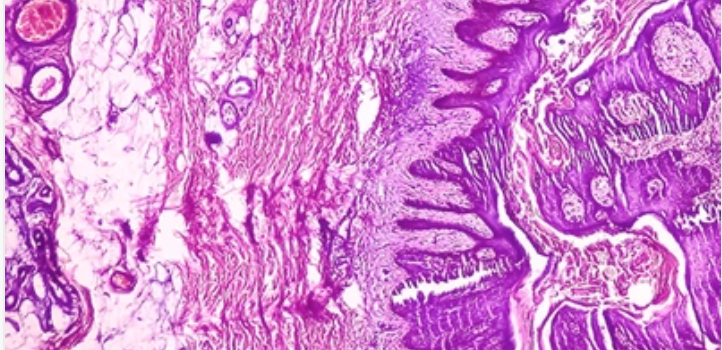Dermatopathology: Masters of Pathology Series