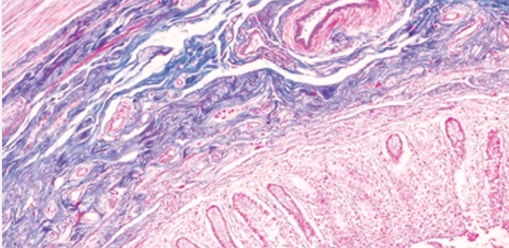 Gastropathology: Masters of Pathology Series