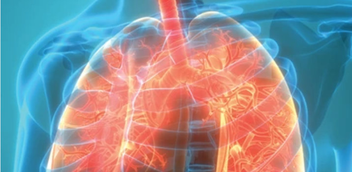 The Brigham Board Review and Comprehensive Update in Pulmonary Medicine