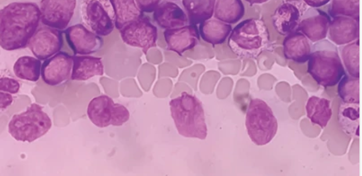 The Brigham and Dana-Farber Board Review and Comprehensive Update in Oncology