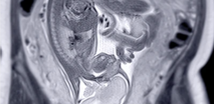 UCSF ObGyn Women’s Imaging