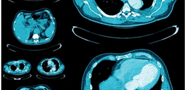 UCSF Abdominal and Thoracic Imaging