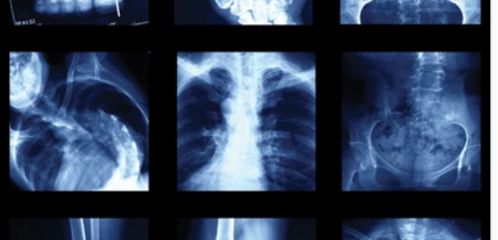 UCSF Imaging: Core and Extremities