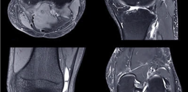 NYU Langone Advanced Imaging of the Musculoskeletal System: Up Your Game