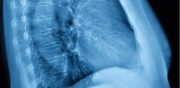 UCSF Thoracic Imaging