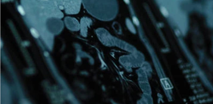 UCSF Abdominal and Pelvic Imaging