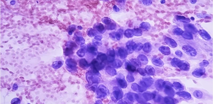 Cytopathology: Masters of Pathology Series