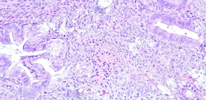 Gynecologic Pathology: Masters of Pathology Series