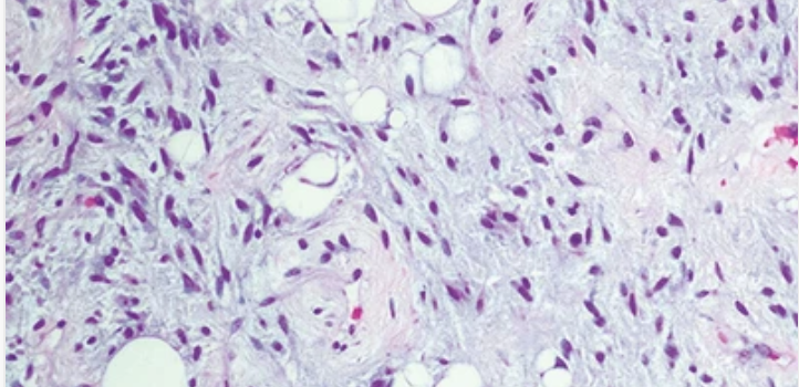 Cleveland Clinic Comprehensive and Immersive Soft Tissue Pathology