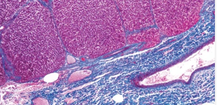 Current Topics in Gastrointestinal and Liver Pathology